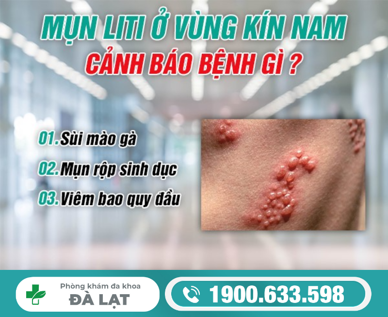 Hình ảnh minh họa